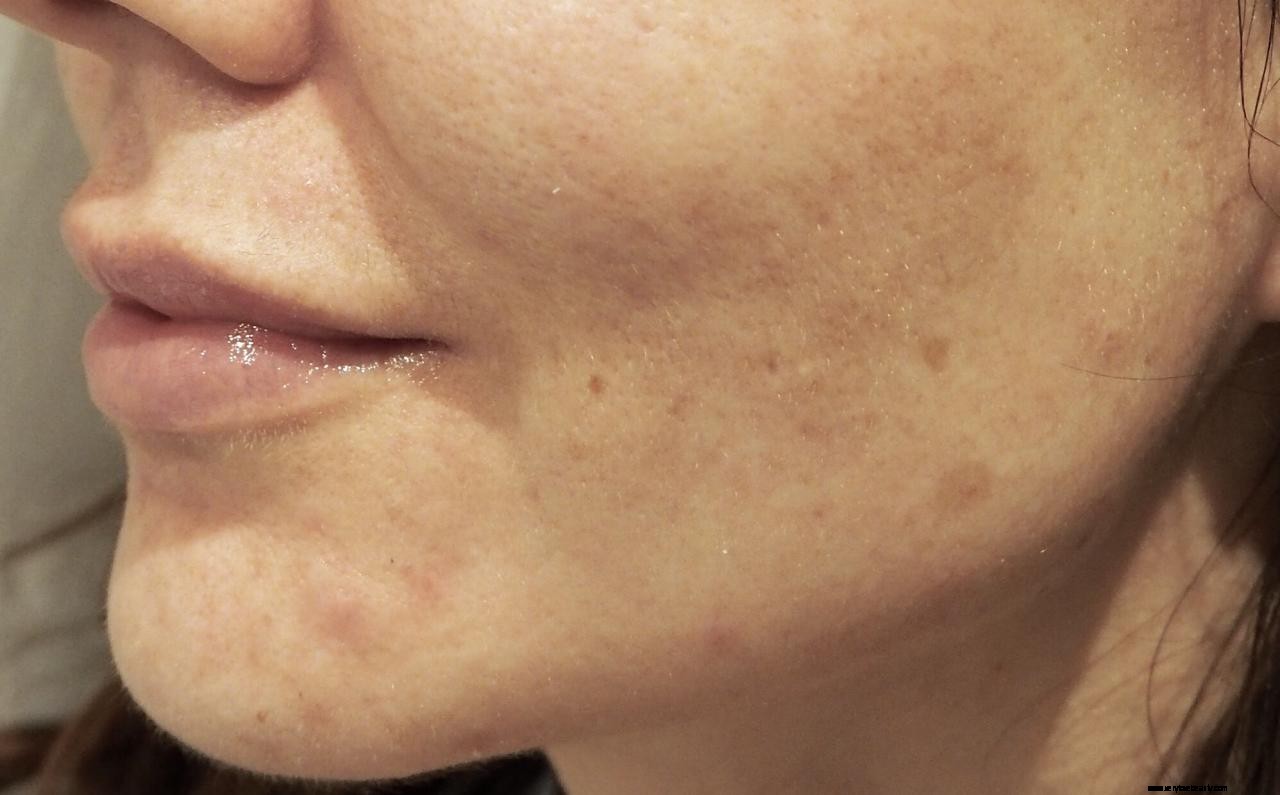 The Ordinary Advanced Retinoid Serum 2%: A Powerful Anti-Aging Solution