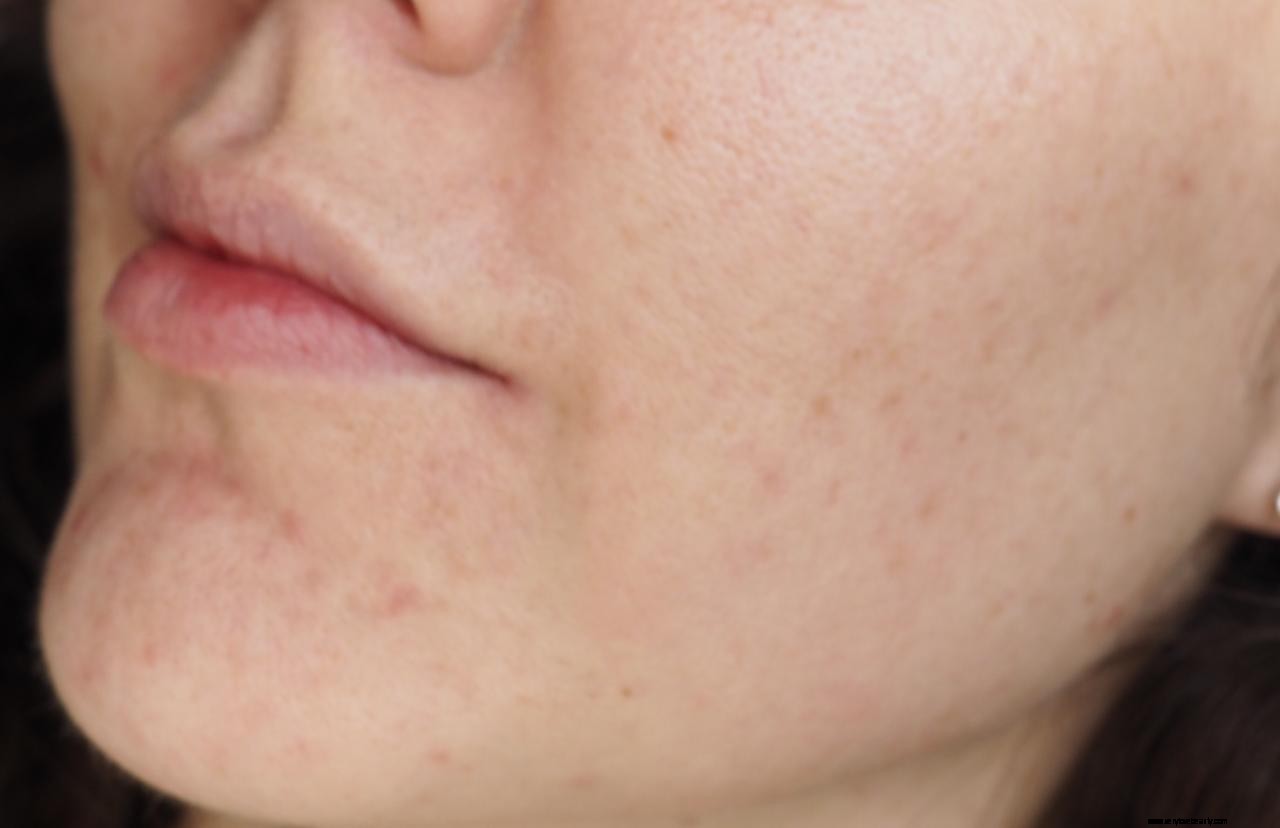 The Ordinary Advanced Retinoid Serum 2%: A Powerful Anti-Aging Solution