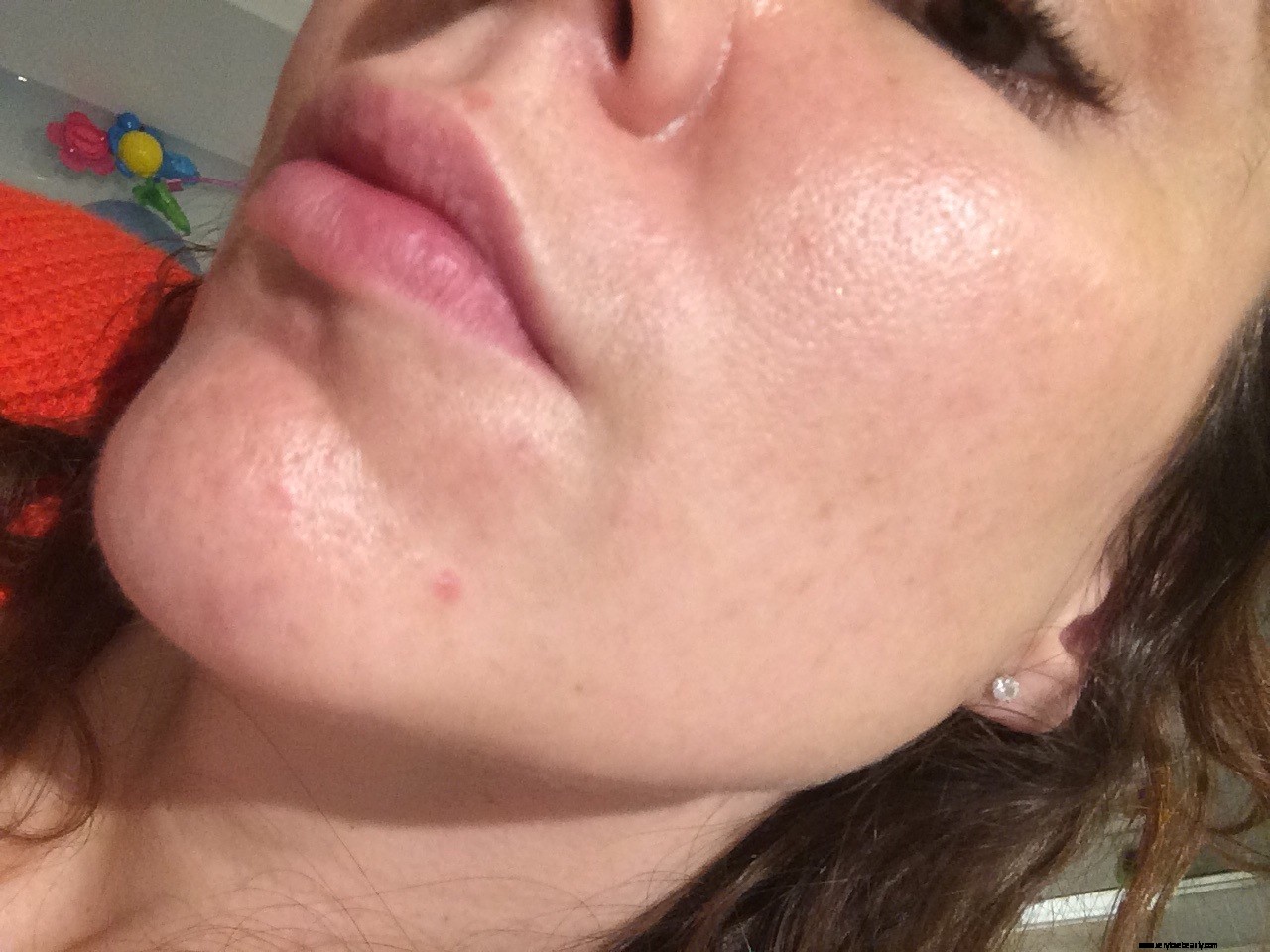 The Ordinary Skincare Results: 5-Week Update & Before/After Photos