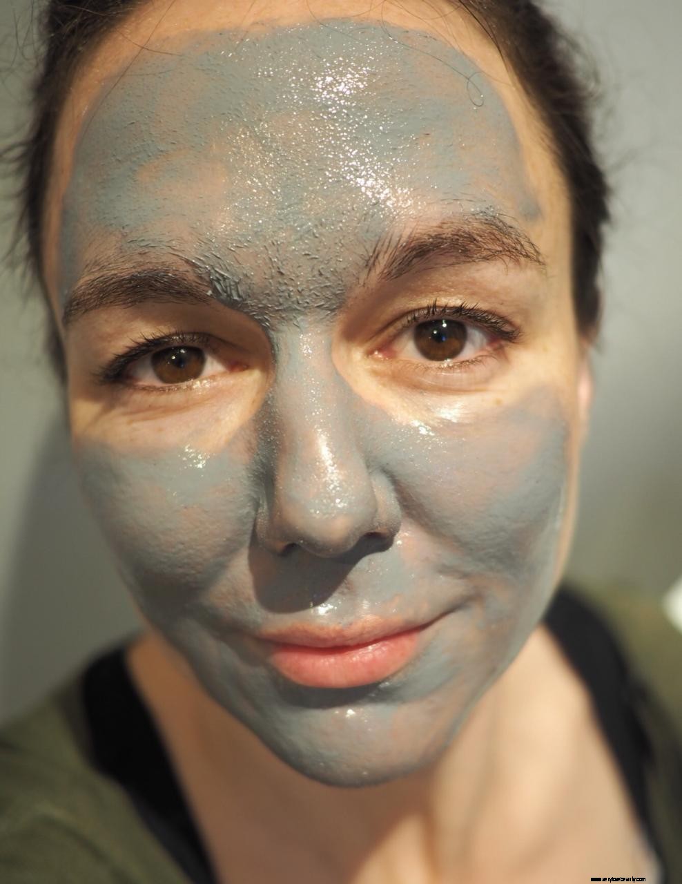 Frezyderm AC-Norm Review: Effective Skincare for Acne-Prone Skin | Expert Opinion