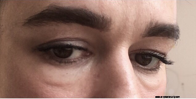 Effective Puffy Eye Remedies: Proven Tips & Tricks