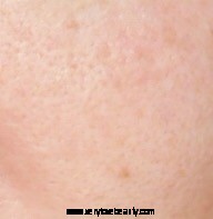 The Ordinary Colours Foundation Review & Shade Guide - First Impressions