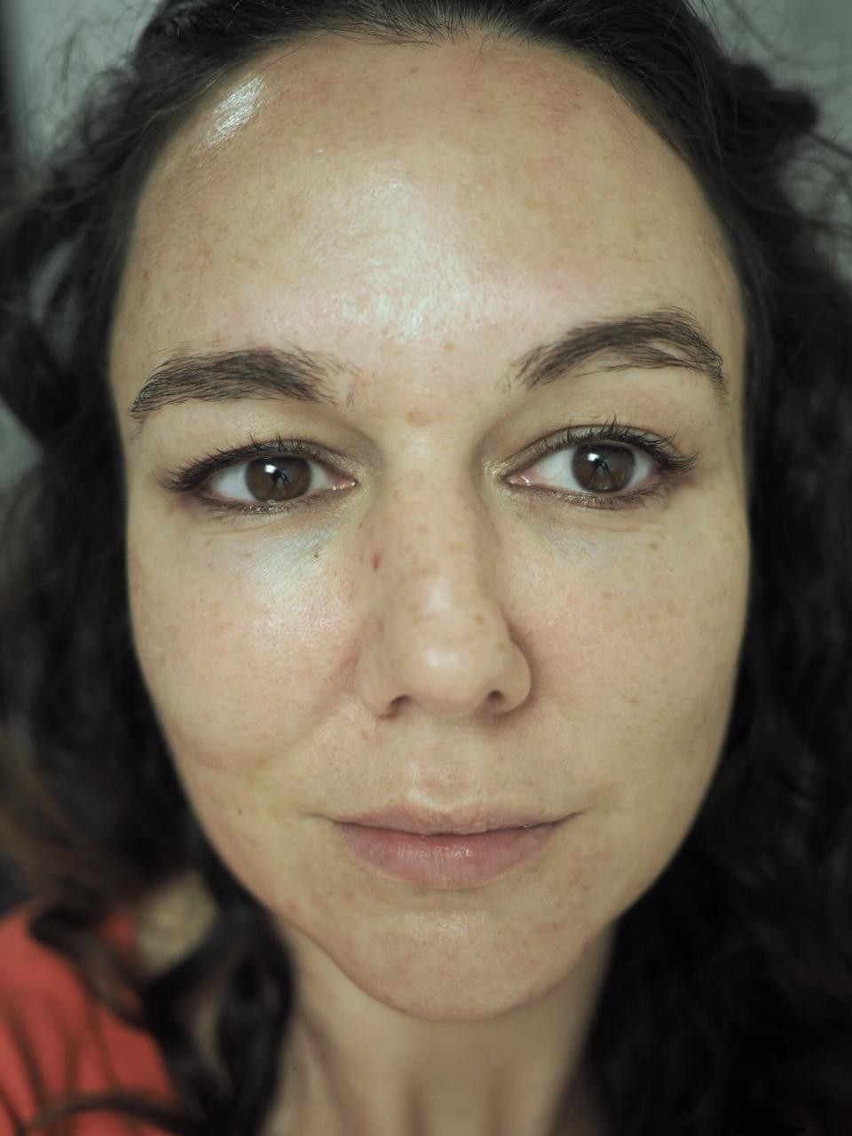 Nannic Radio Frequency Facial Treatment Review: Is It Worth It?