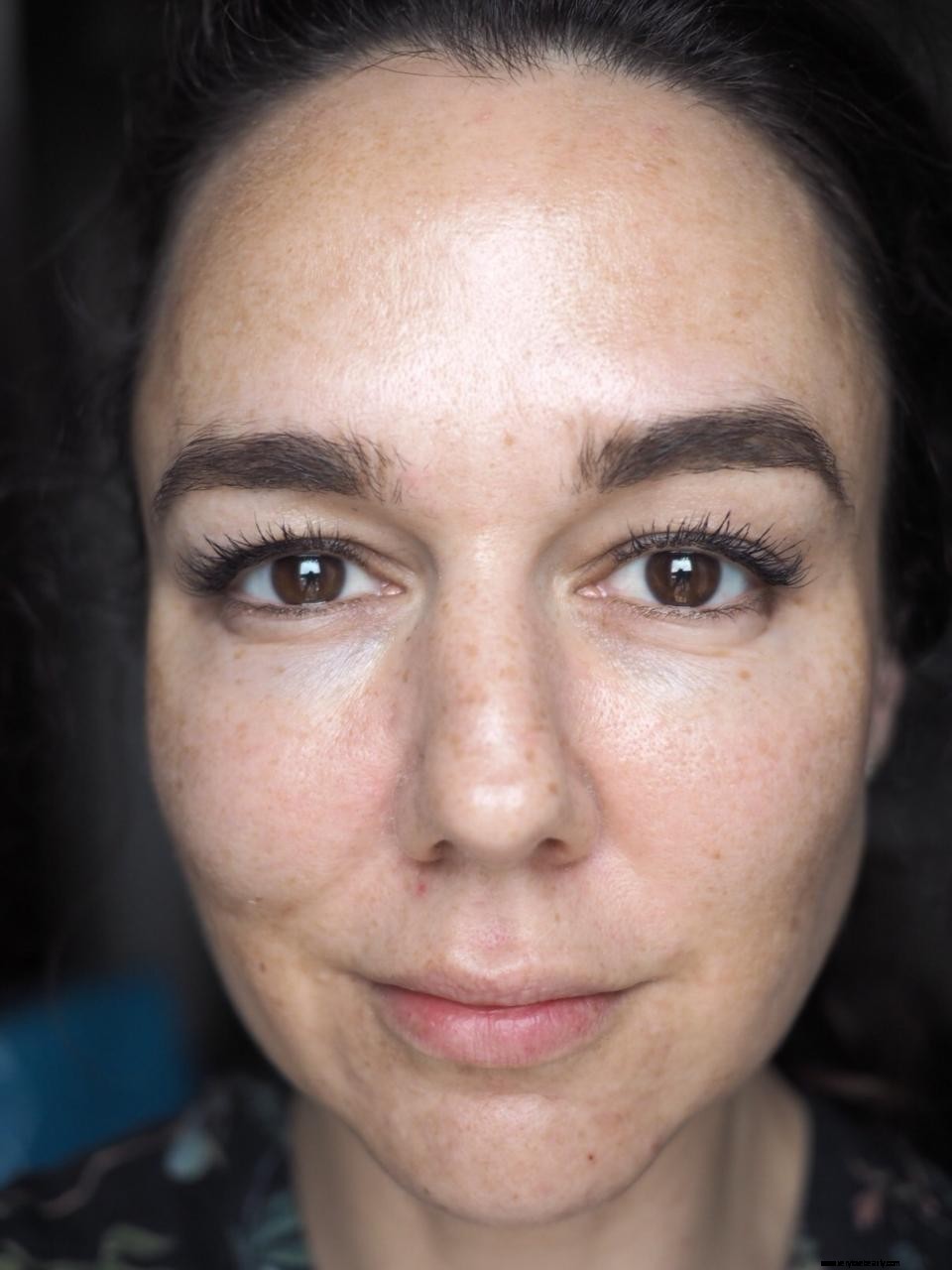 Nannic Radio Frequency Facial Treatment Review: Is It Worth It?