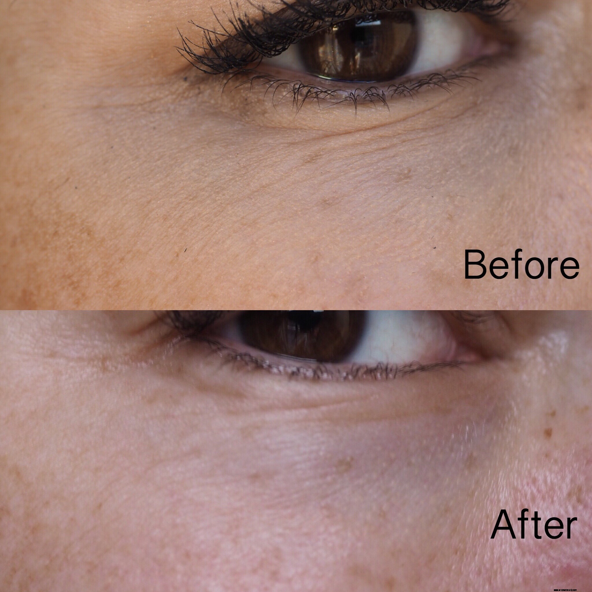 Yana Collagen Shots Review: Does Image Skincare Deliver?