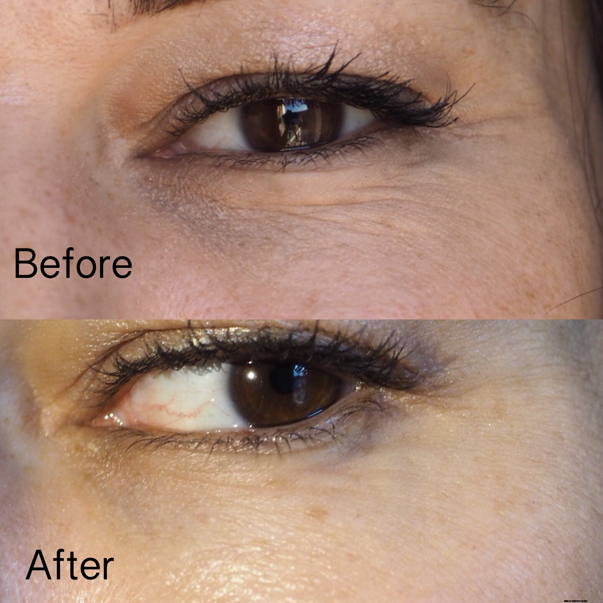Yana Collagen Shots Review: Does Image Skincare Deliver?