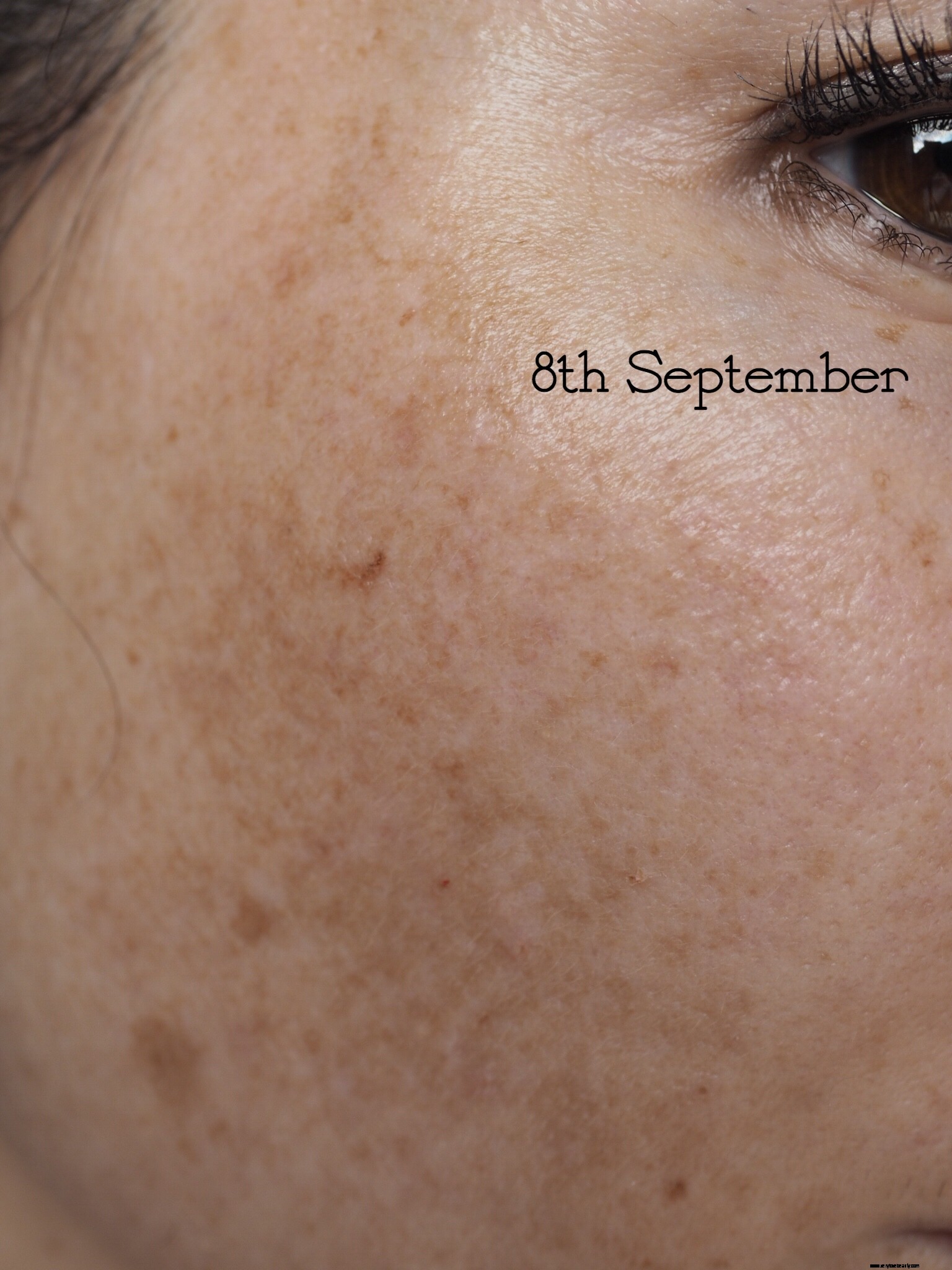 NIOD Re Pigment Review: Does it Fade Dark Spots? (Before & After)