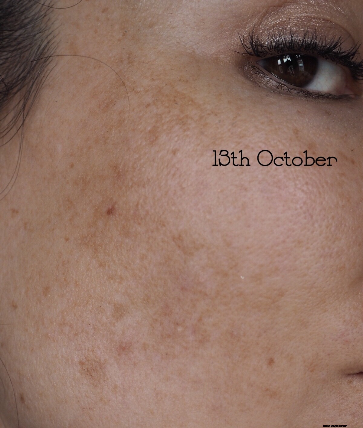 NIOD Re Pigment Review: Does it Fade Dark Spots? (Before & After)