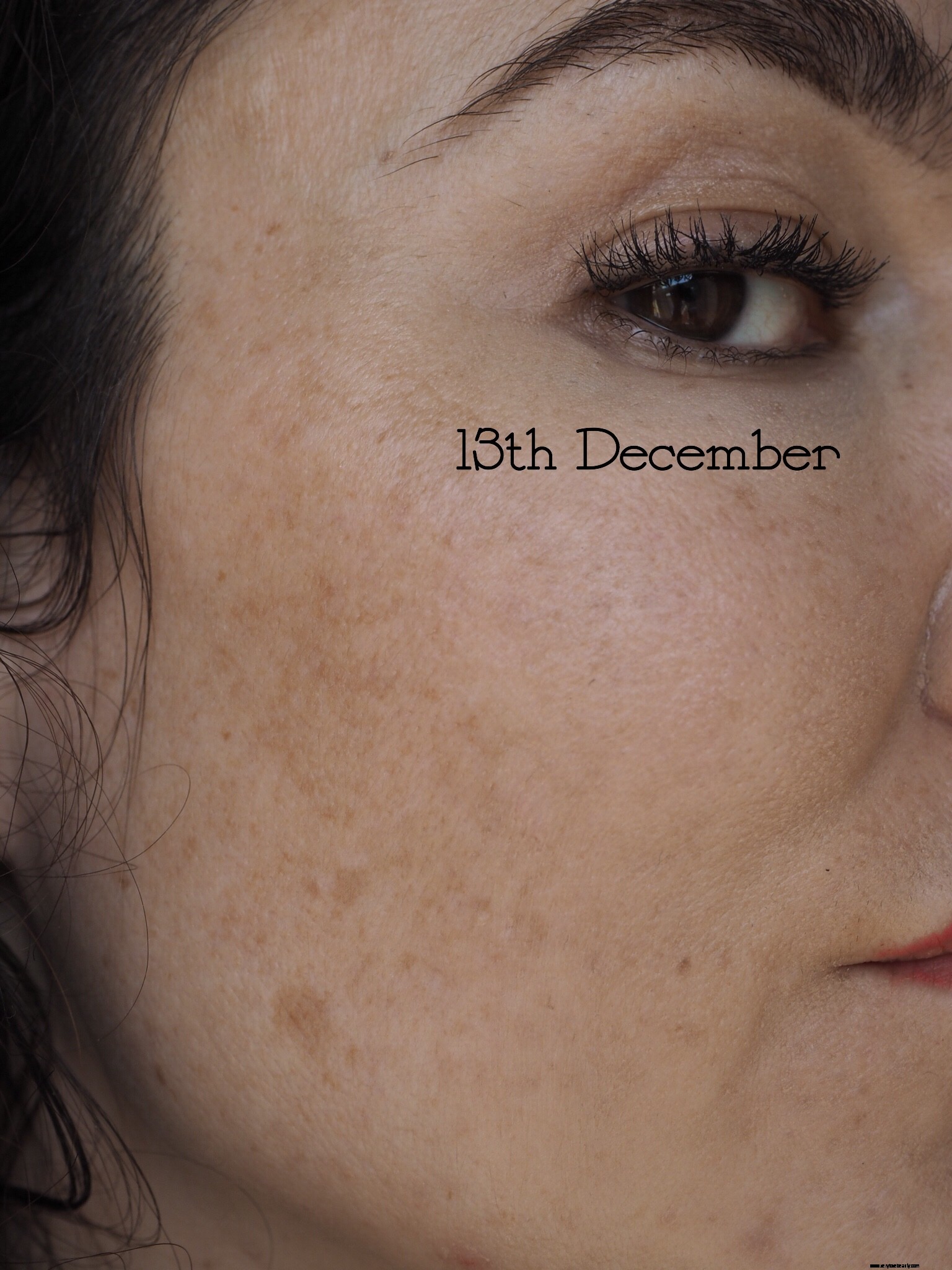 NIOD Re Pigment Review: Does it Fade Dark Spots? (Before & After)