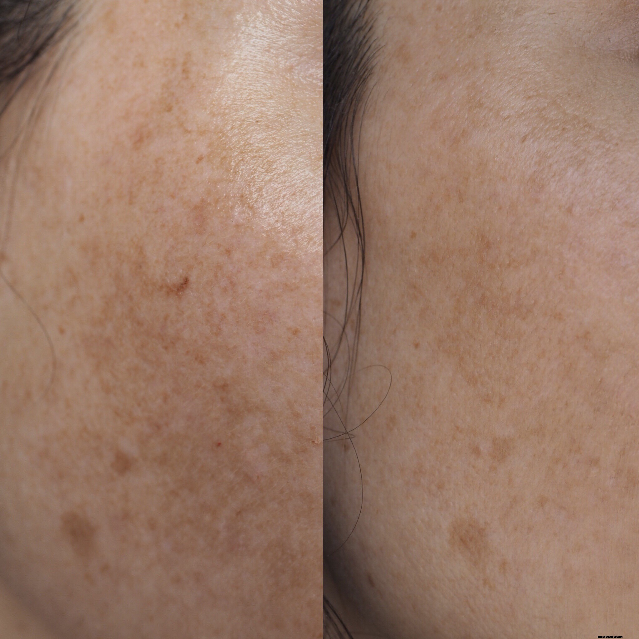 NIOD Re Pigment Review: Does it Fade Dark Spots? (Before & After)