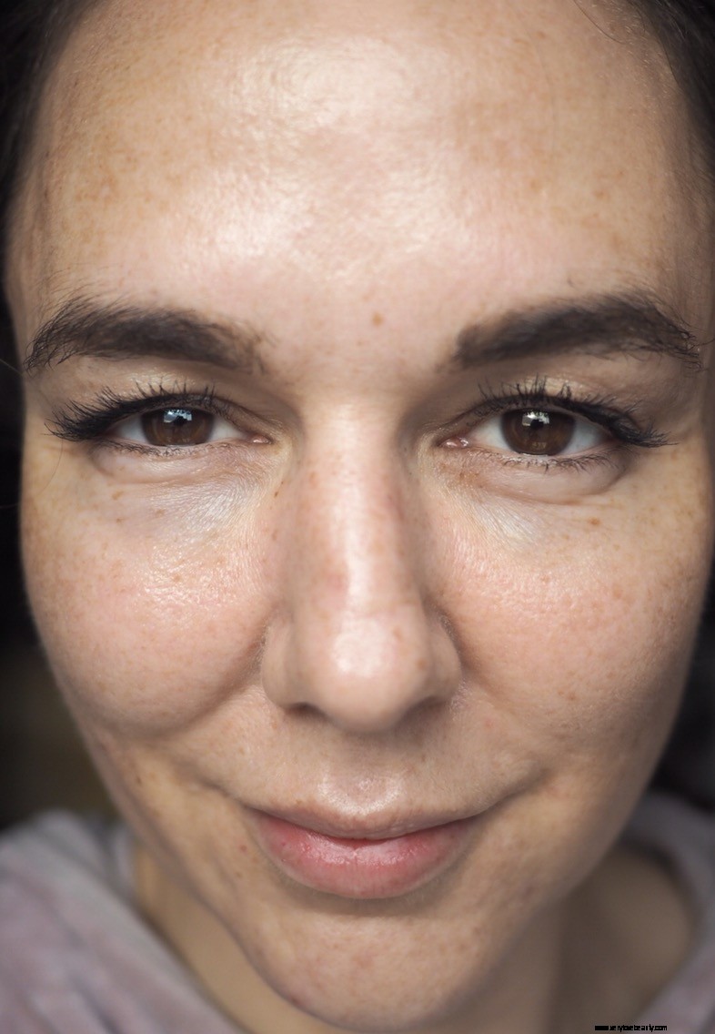 Acne, Aging & Pigmentation Skincare: A Personal Journey