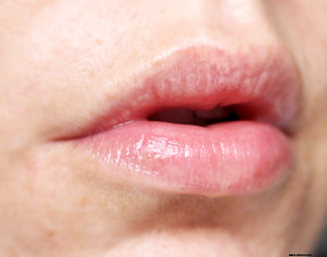 Balmkind Alpine Rose & Lysine Lip Balm Review: Hydration & Protection