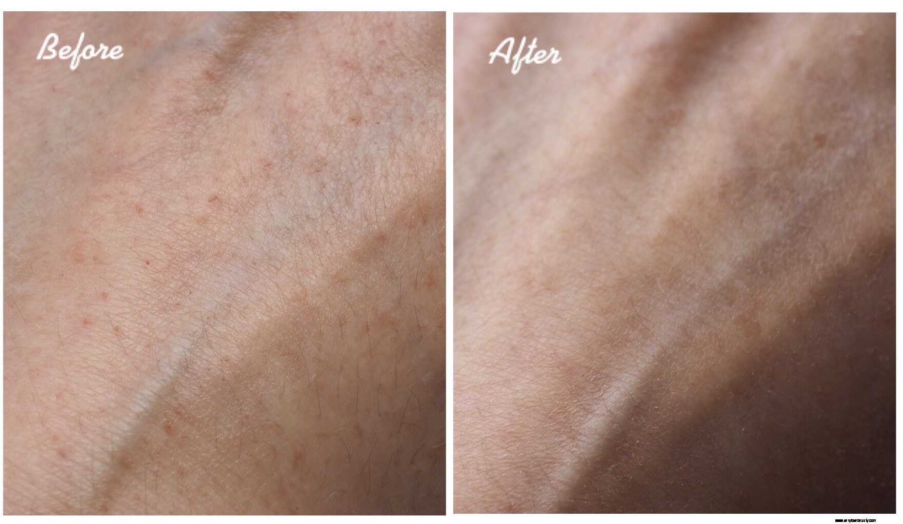 NIOD Modulating Glucosides Review: A Deep Dive for Eczema & Dermatitis