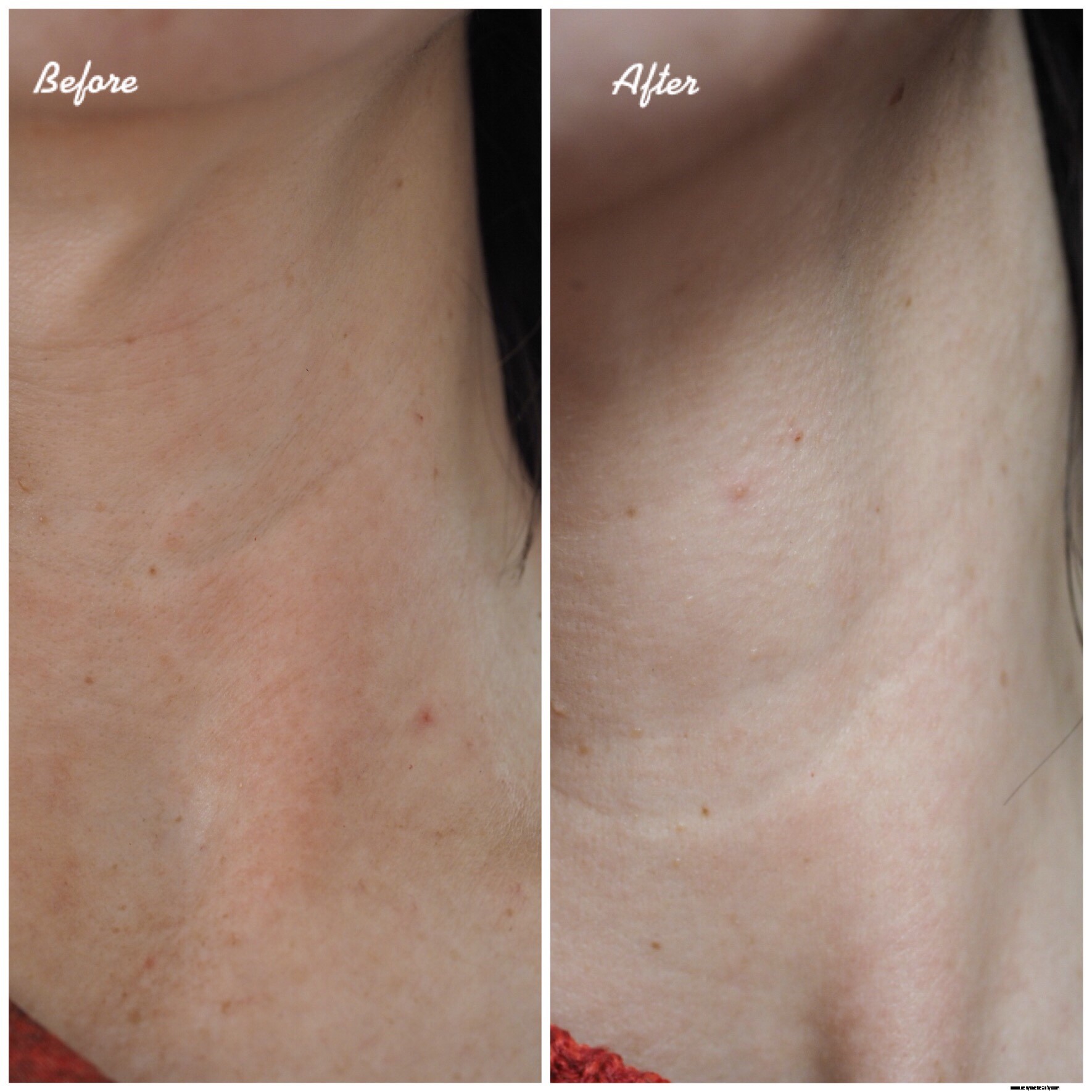 NIOD Modulating Glucosides Review: A Deep Dive for Eczema & Dermatitis