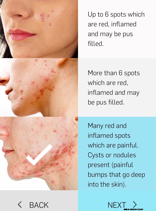 Dermatica UK Review: Online Dermatology & Prescription Skincare