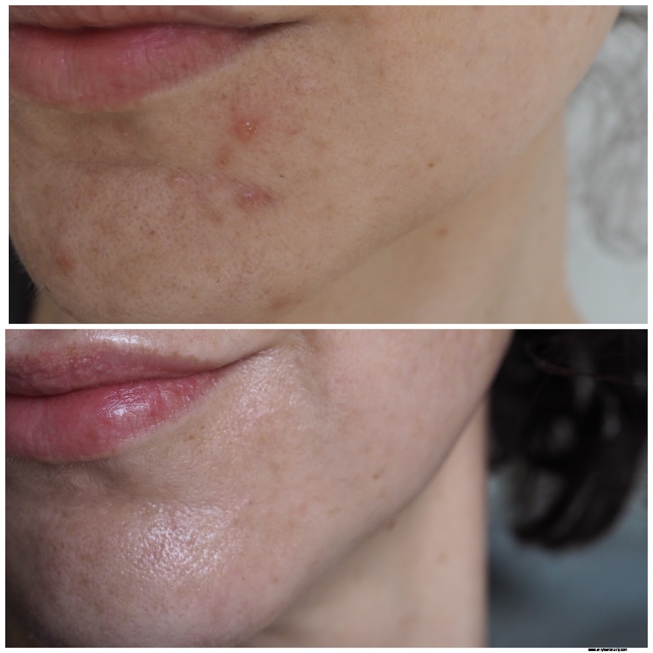 Dermatica UK Review: Online Dermatology & Prescription Skincare