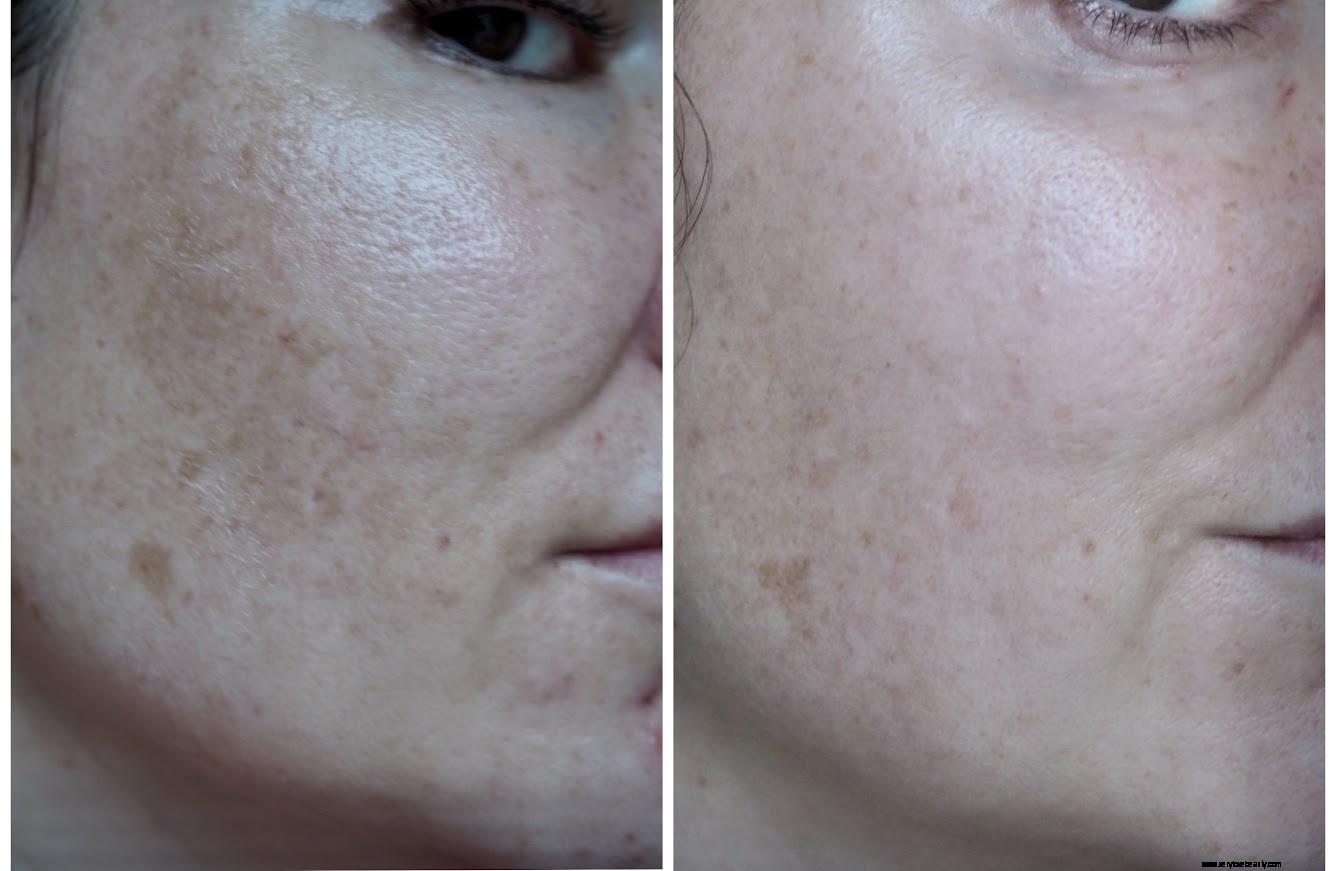 Dermatica UK Review: Online Dermatology & Prescription Skincare