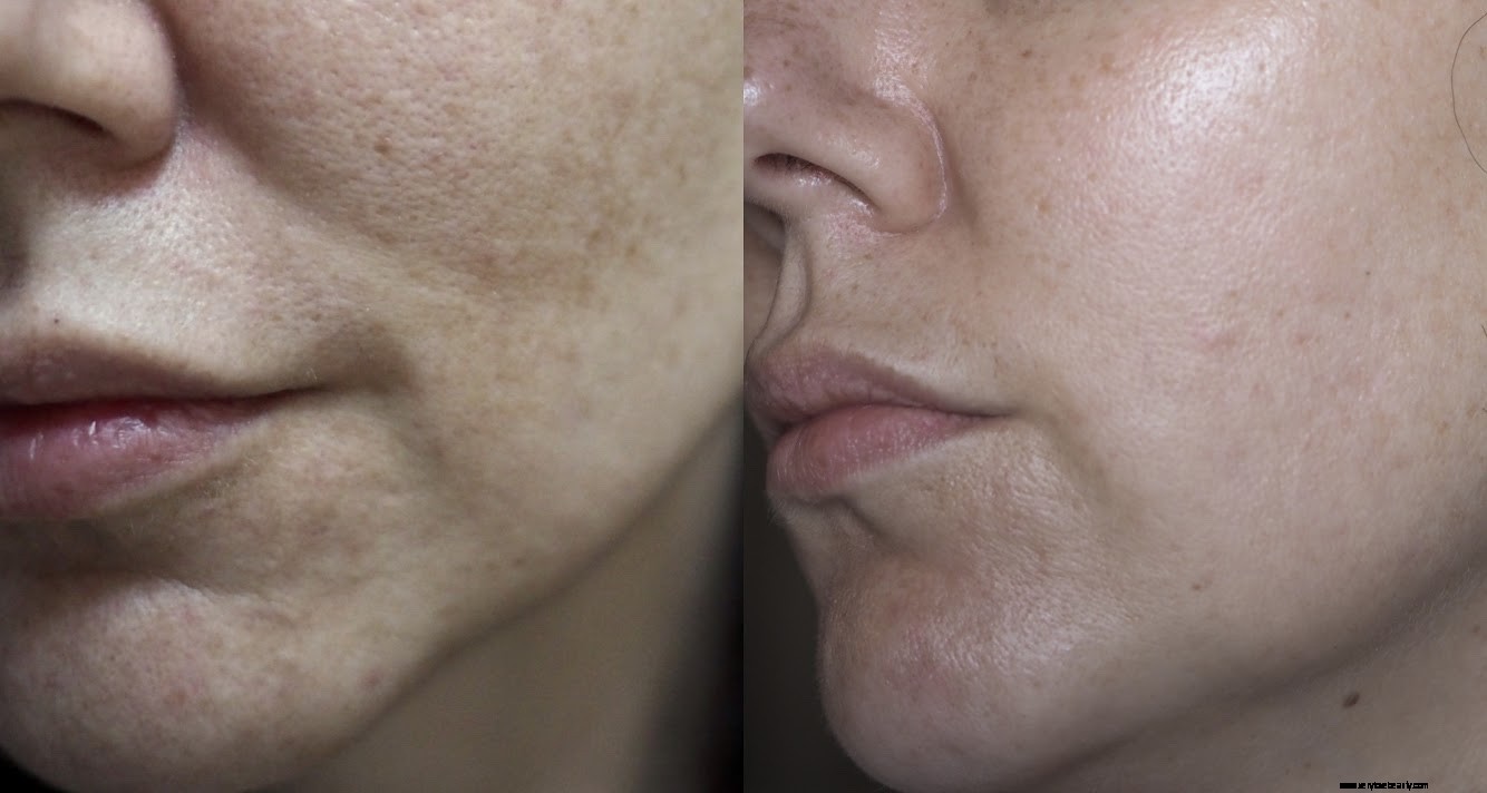 Dermatica UK Review: Online Dermatology & Prescription Skincare