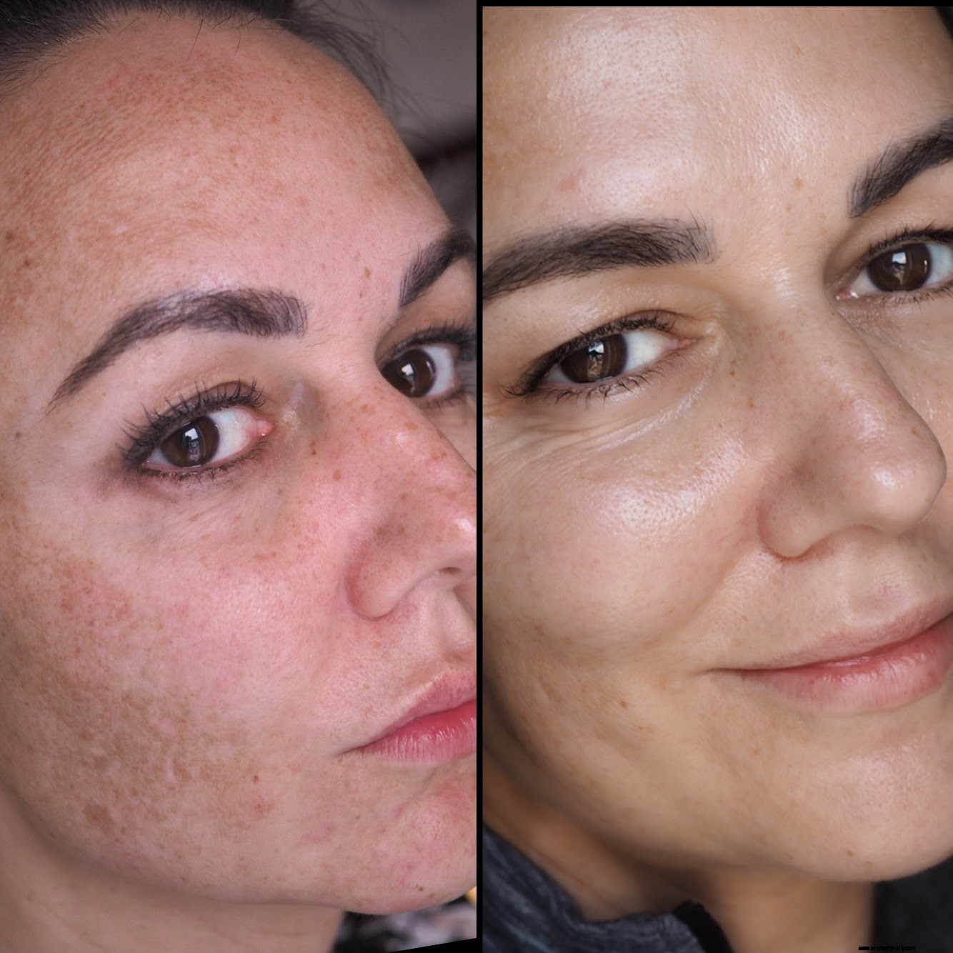 Dermatica UK Review: Online Dermatology & Prescription Skincare