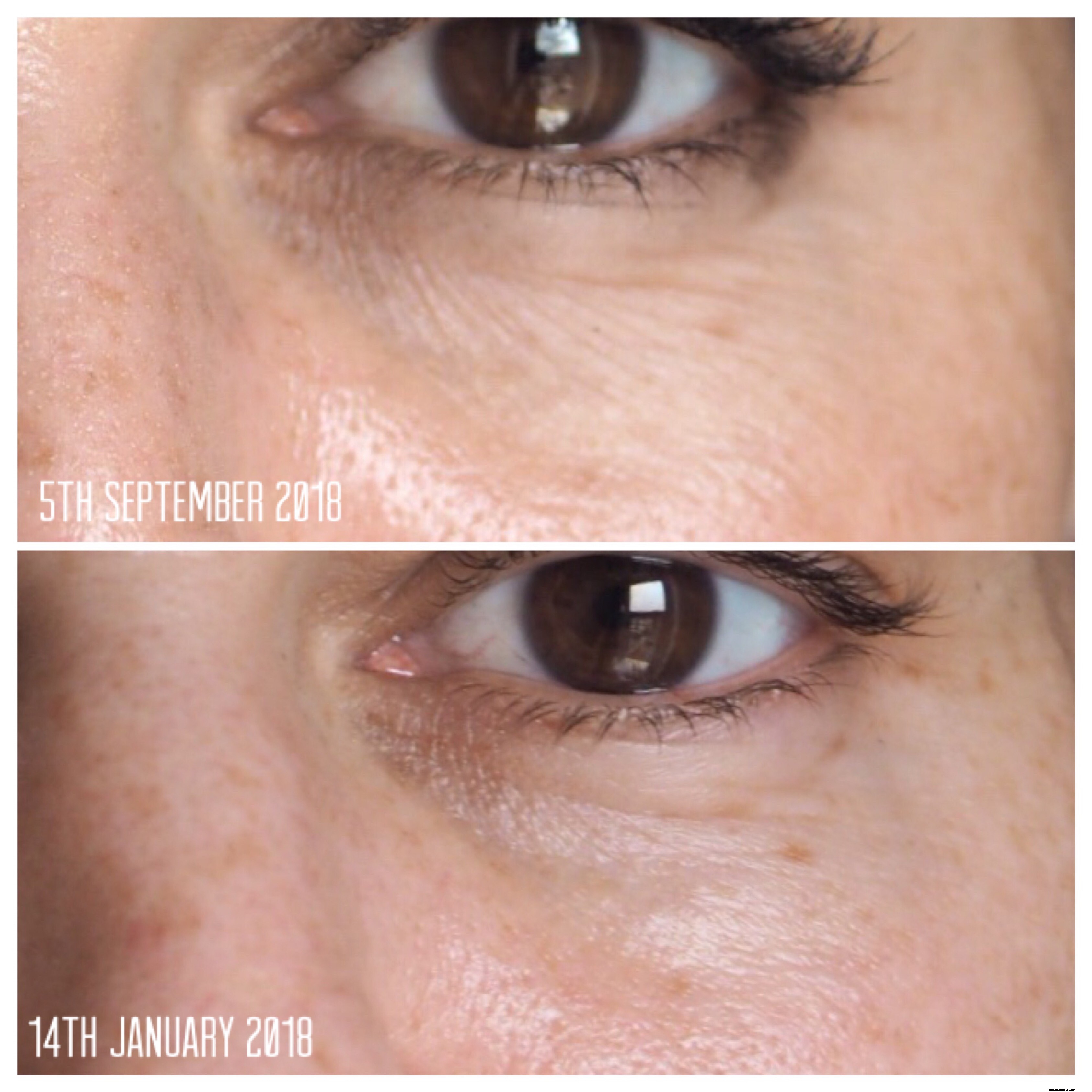 Imedeen Derma One Review: Does it Deliver on Skin Health?