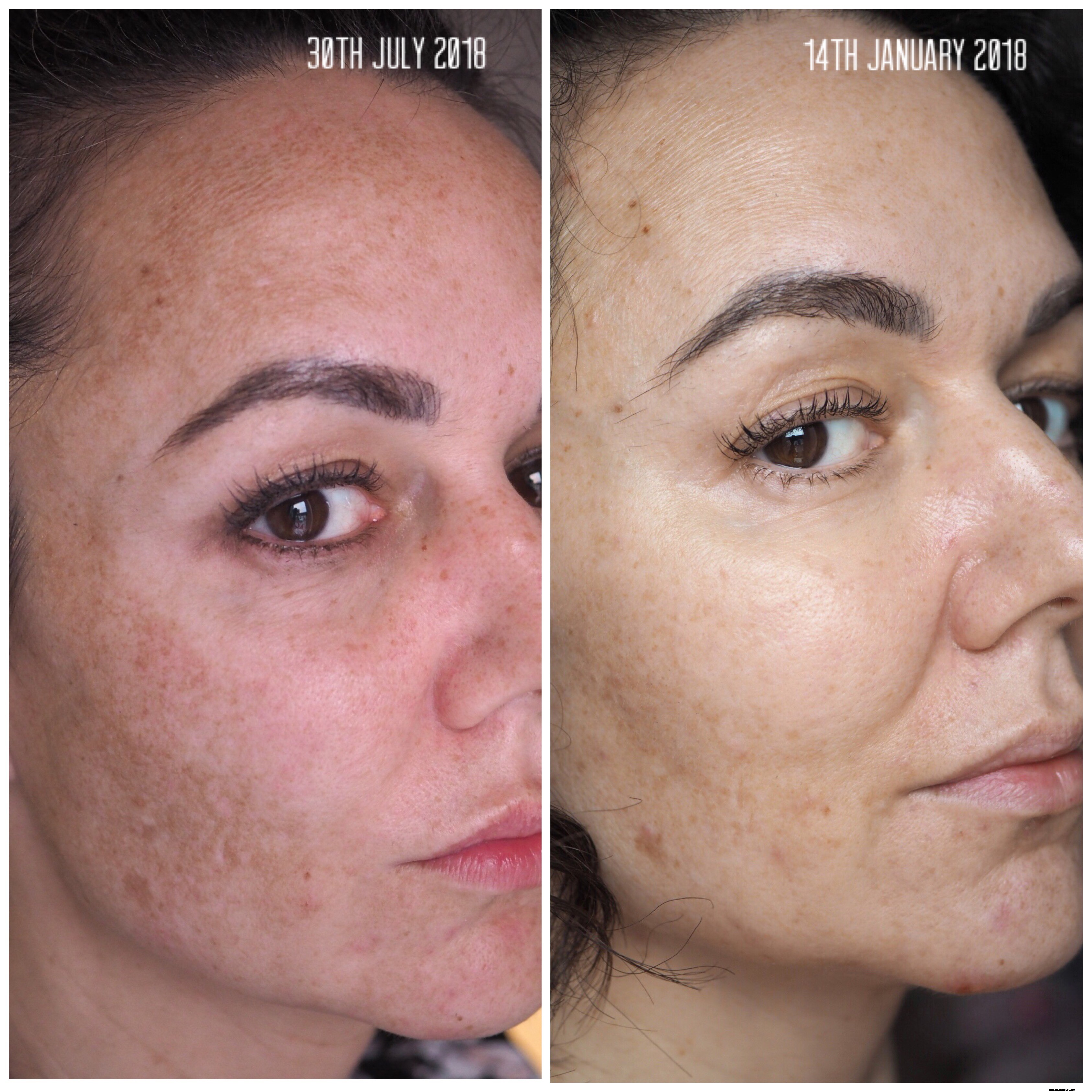 Imedeen Derma One Review: Does it Deliver on Skin Health?
