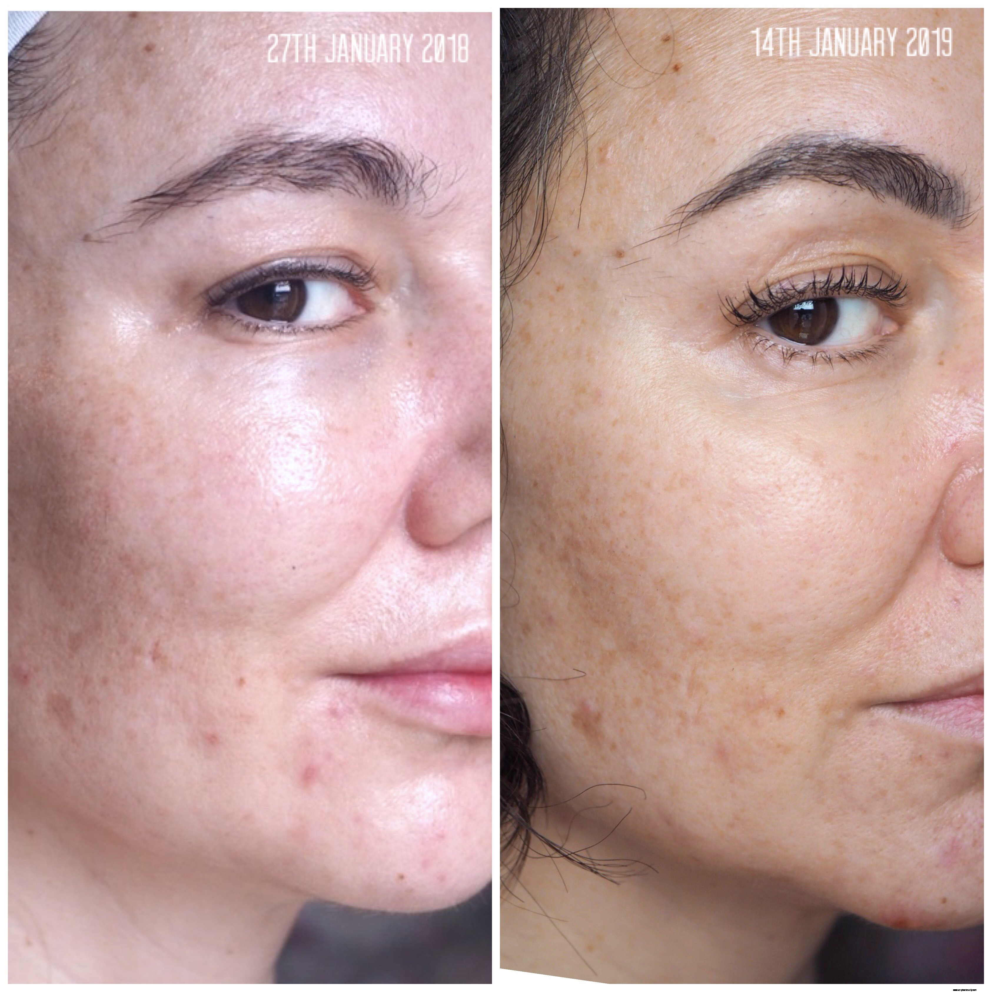 Imedeen Derma One Review: Does it Deliver on Skin Health?