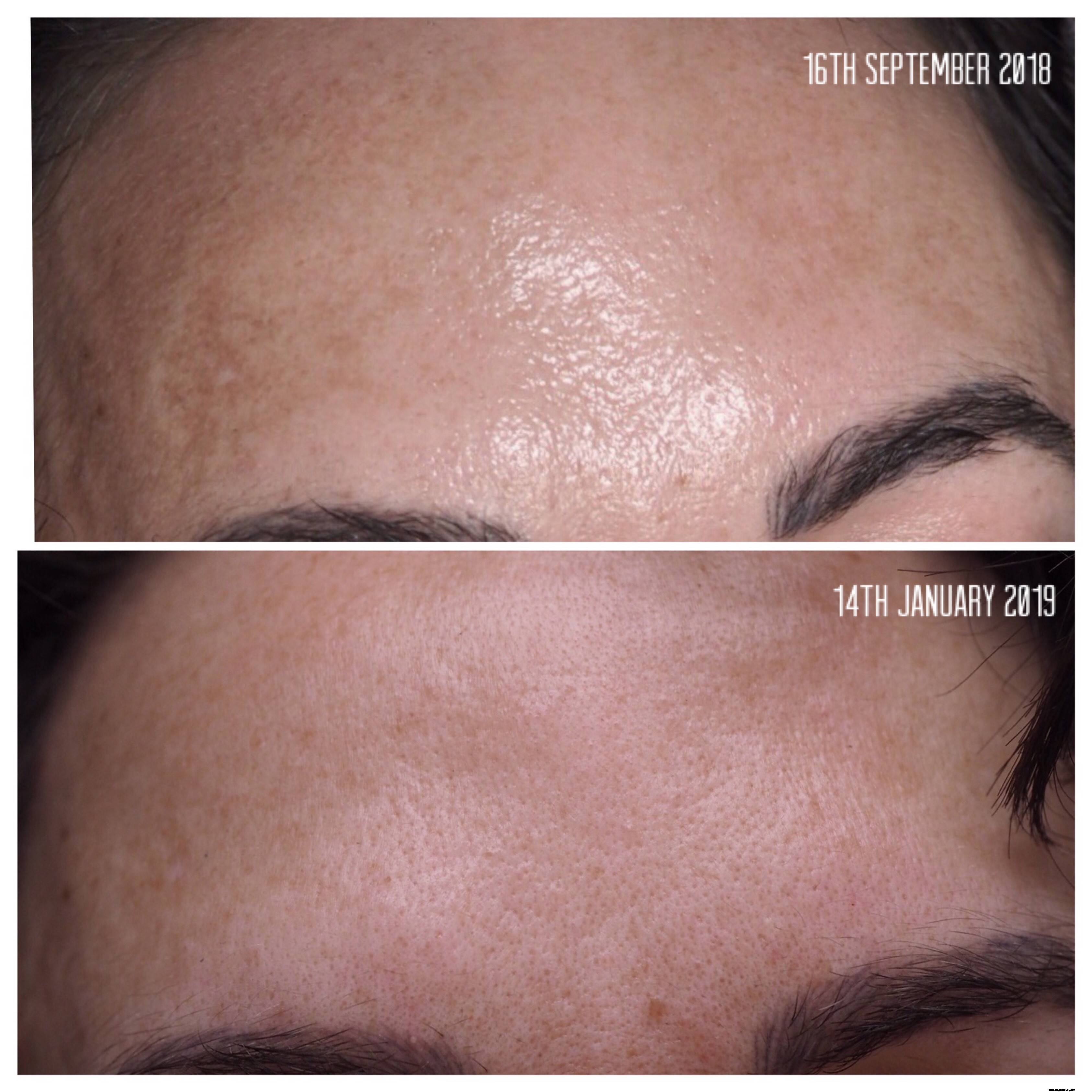 Imedeen Derma One Review: Does it Deliver on Skin Health?