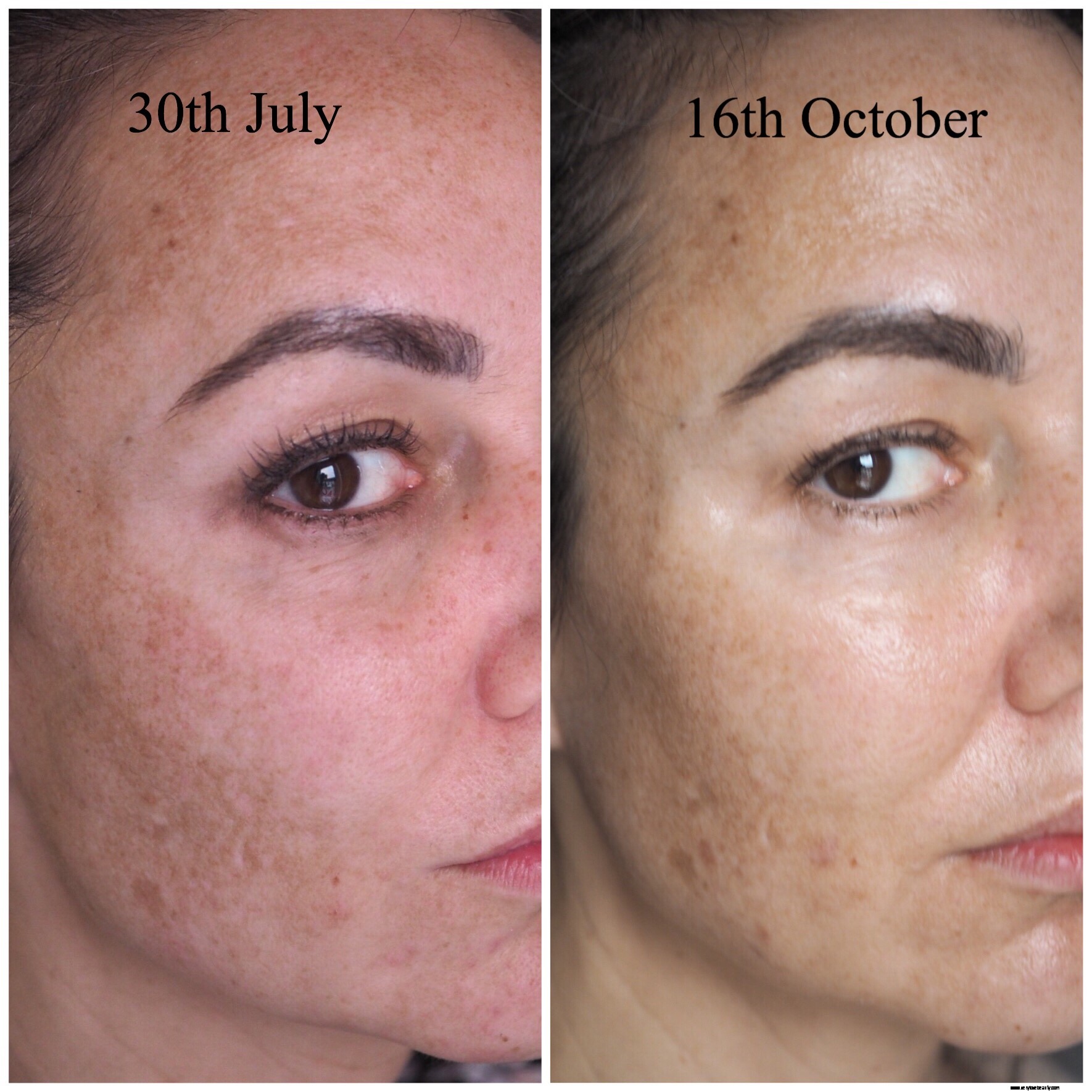 Ishtar Skinlights Skincare Review: Honest & Detailed First Impressions