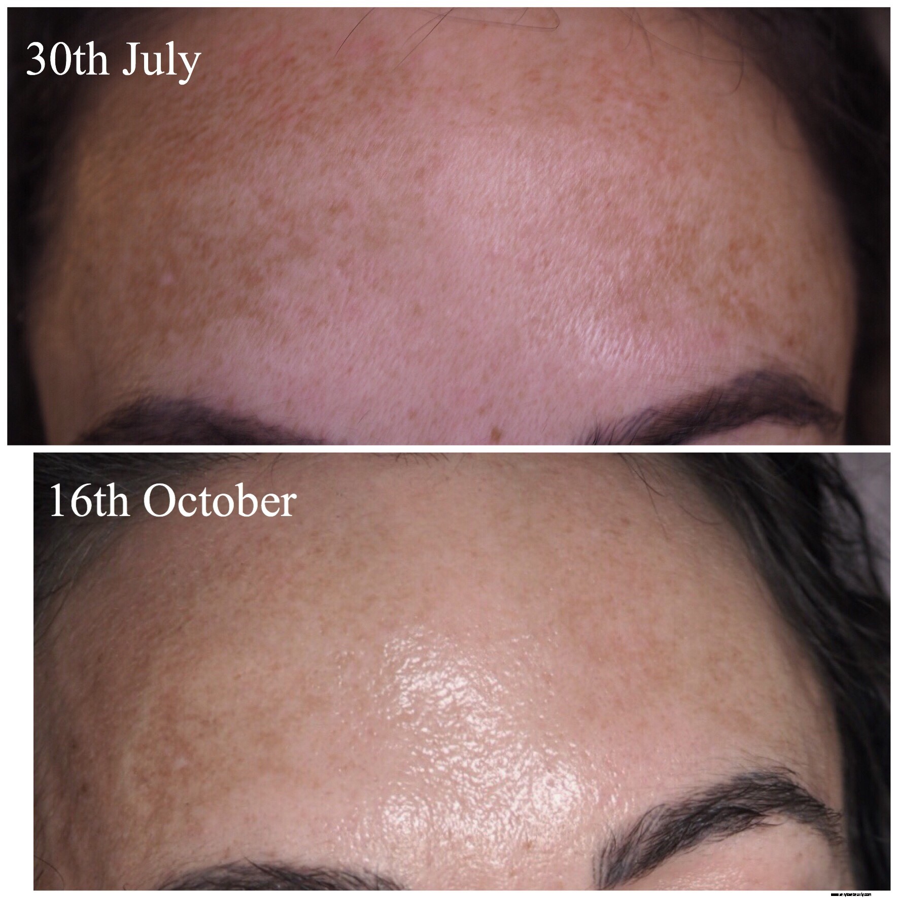 Ishtar Skinlights Skincare Review: Honest & Detailed First Impressions