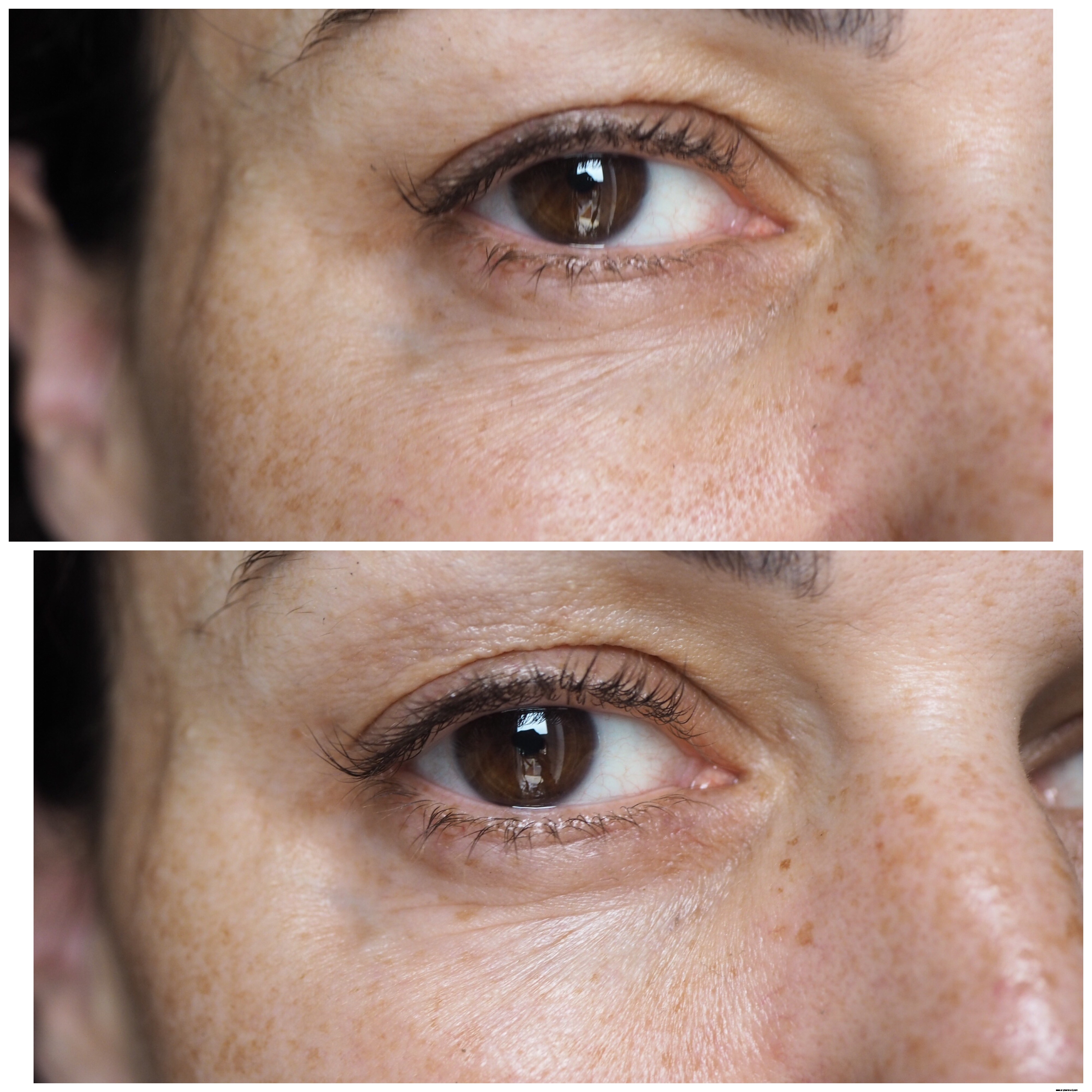 Instant Effects Skincare Review: Is It Worth the Hype?