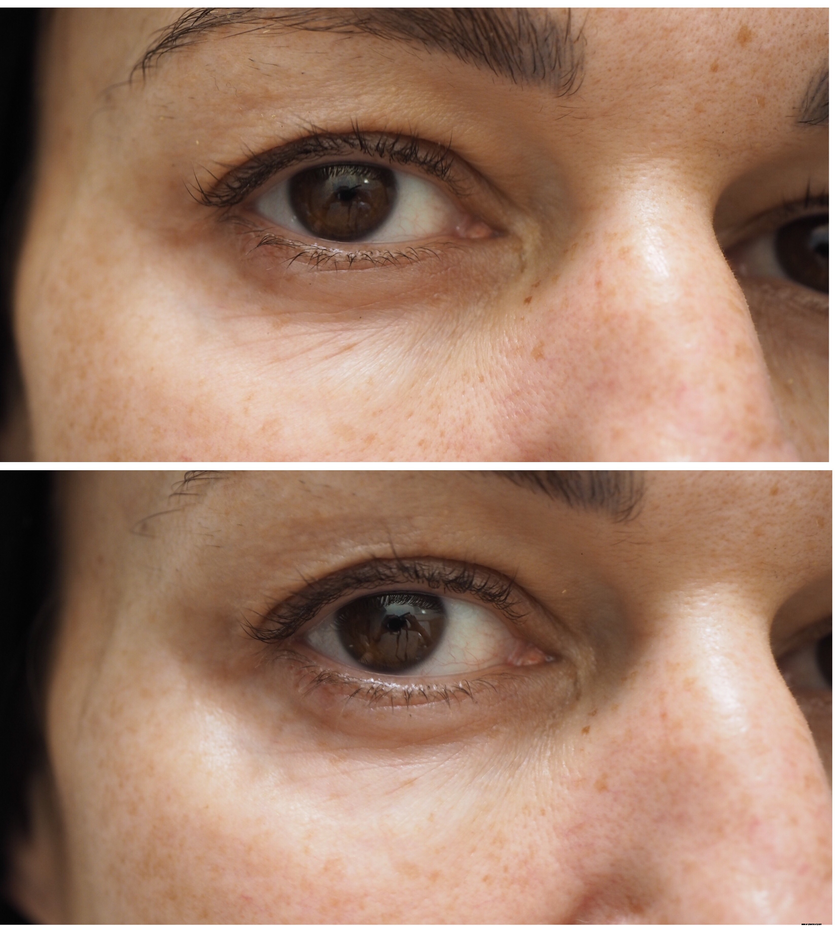 Instant Effects Skincare Review: Is It Worth the Hype?