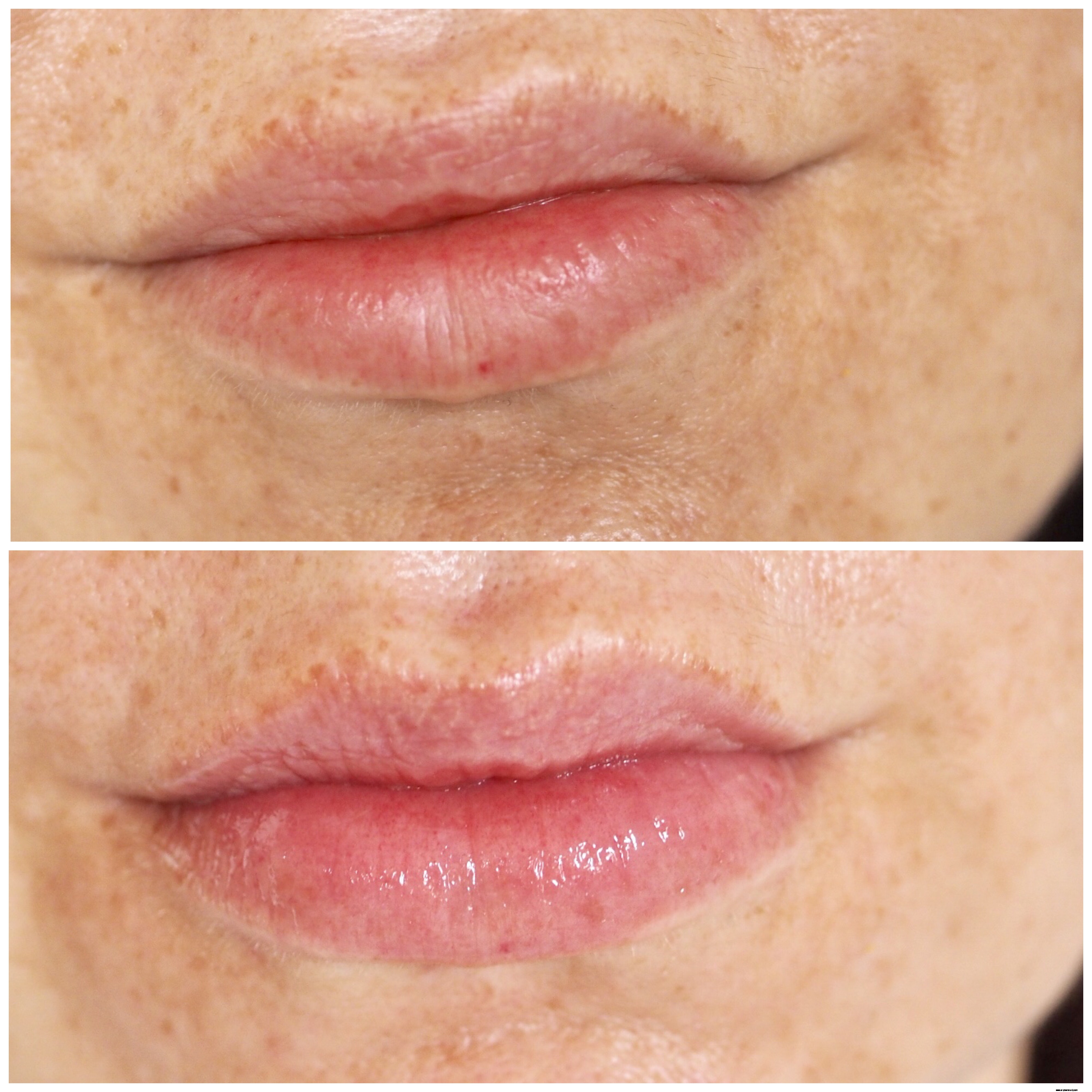 Instant Effects Skincare Review: Is It Worth the Hype?
