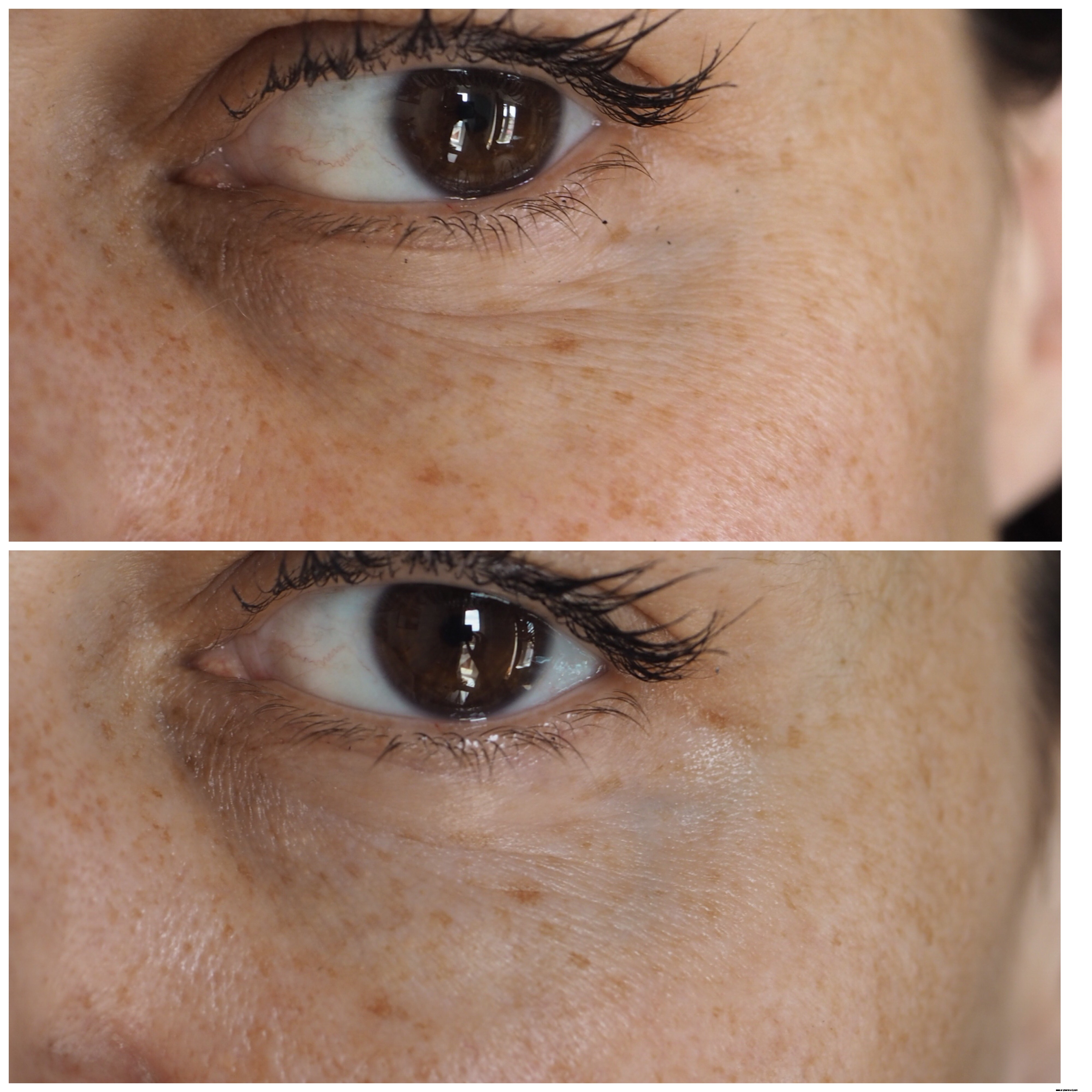 Instant Effects Skincare Review: Is It Worth the Hype?