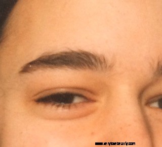 Eyebrow Regrowth Journey: 8 Months of Recovery & Progress