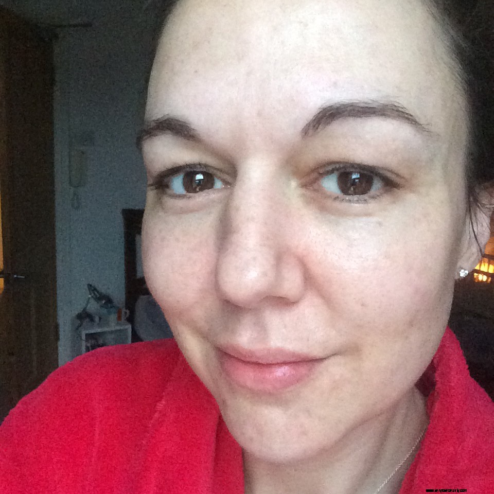 Eyebrow Regrowth Journey: 8 Months of Recovery & Progress