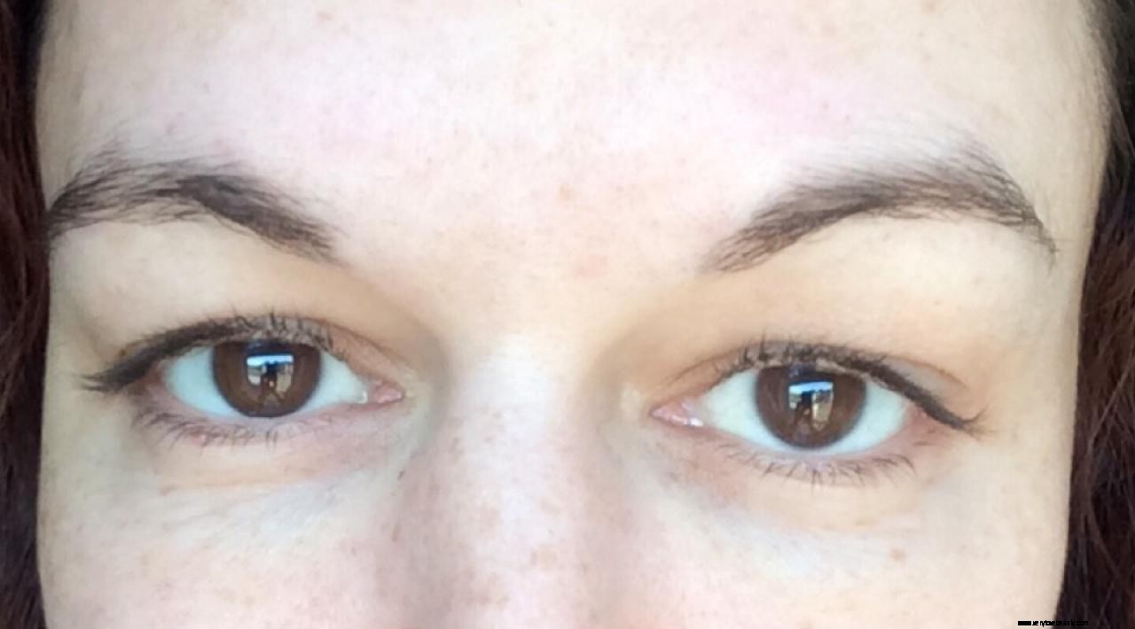 Eyebrow Regrowth Journey: 8 Months of Recovery & Progress