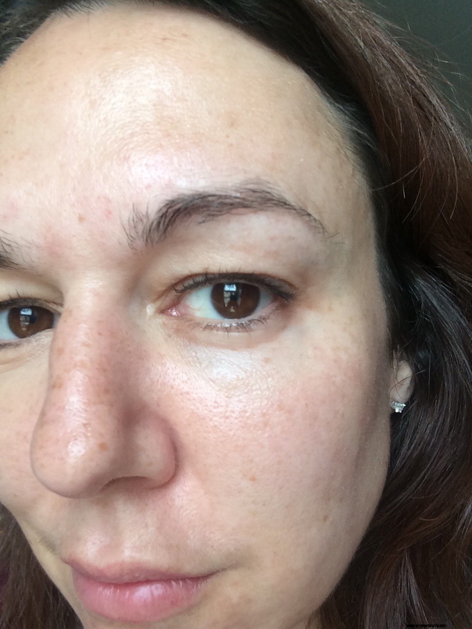 Eyebrow Regrowth Journey: 8 Months of Recovery & Progress