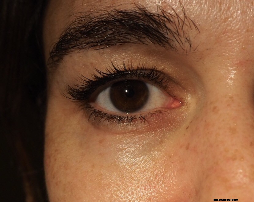 Eyebrow Regrowth Journey: 8 Months of Recovery & Progress