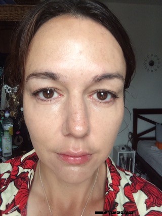Eyebrow Regrowth Journey: 8 Months of Recovery & Progress