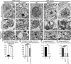 Mitochondrial & ER Stability: A Potential Therapeutic Target for Motor Neuron Degeneration