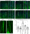 Mitochondrial & ER Stability: A Potential Therapeutic Target for Motor Neuron Degeneration