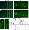 Mitochondrial & ER Stability: A Potential Therapeutic Target for Motor Neuron Degeneration