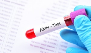 Understanding AMH Levels: Testing, Interpretation & Fertility