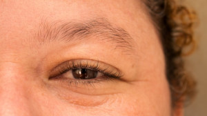 LASIK and Dry Eye: Risks, Causes & Prevention - A Comprehensive Guide