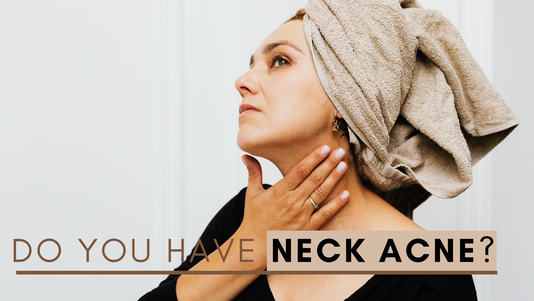 Neck Acne Explained: Causes, Symptoms, and Proven Treatment Strategies