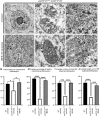 Stabilité des mitochondries et des ER :une cible thérapeutique potentielle pour la dégénérescence des motoneurones 